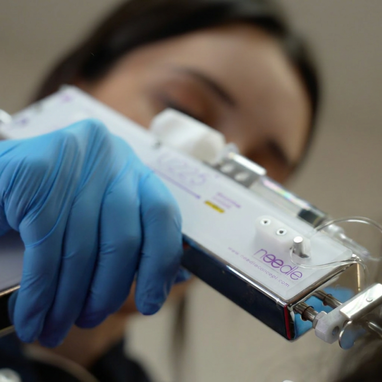 Les Skinboosters pour le Cuir Chevelu Hyeres docteur audrey simon