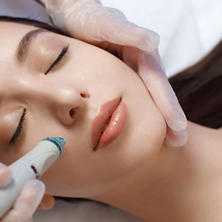 Microneedling HYERES docteur audrey simon